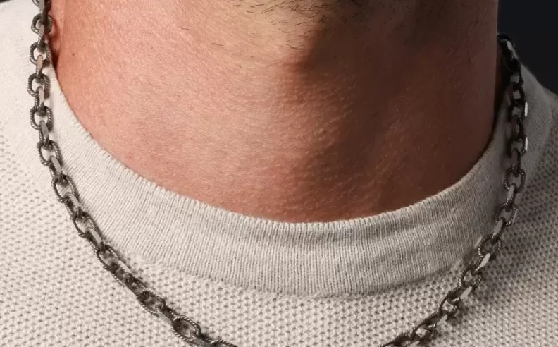سلسلة الكابل (Cable Chain)