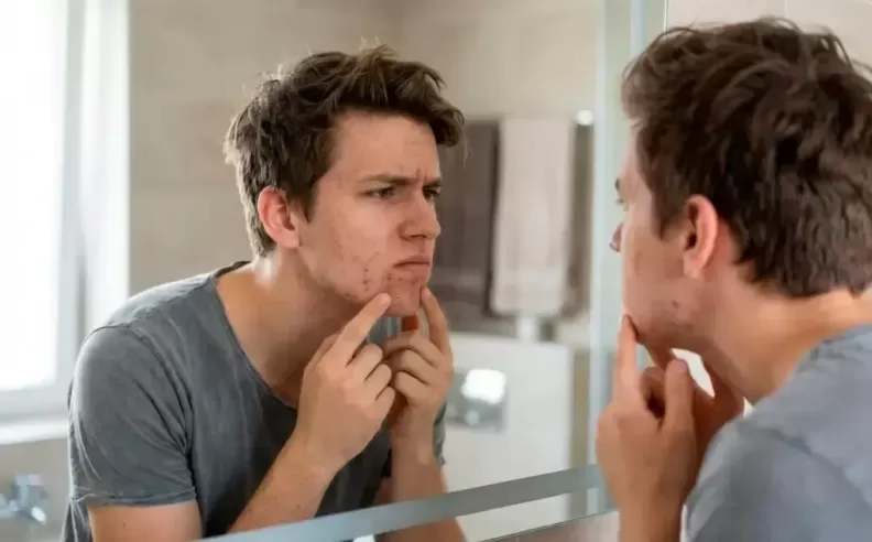The Real Issue Behind Men’s Acne